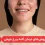 روش‌های درمان آکنه