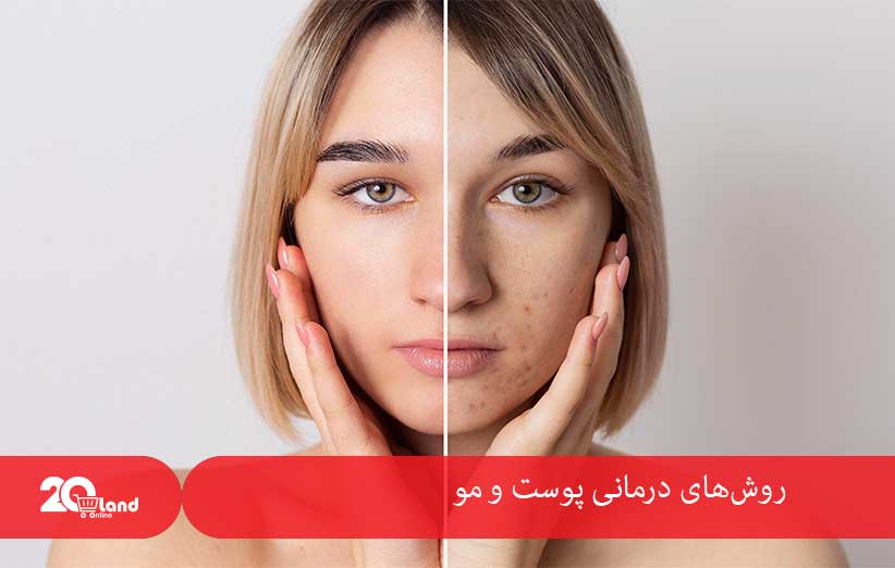 روش‌های درمانی پوست و مو